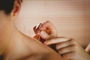 acupuncture schools in new york